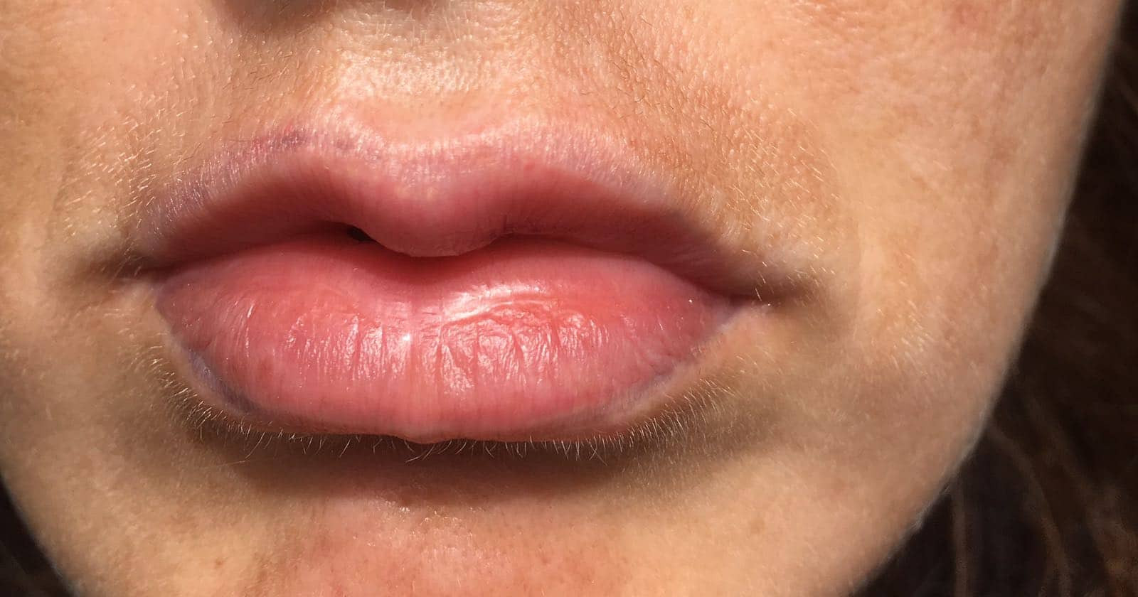 Lippen Permanent Make Up entfernen durch den Profi | RT ...